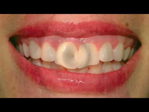 Sonrisas Perfectas: La Importancia de la Ortodoncia