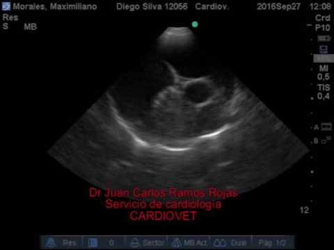 Osteocondrosi della colonna vertebrale lombosacrale con sindrome radicolare Le migliori cliniche di Mosca per la sostituzione dellarticolazione