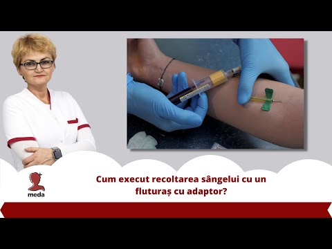 ce fel de vitamine sunt necesare în varicoza