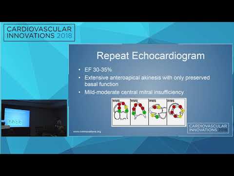 CVI2018 Coronary Challenging Case Competition: Semifinals 1 - Debraj Das, MD