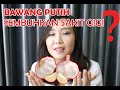 Can Garlic Cure Toothache Is It True