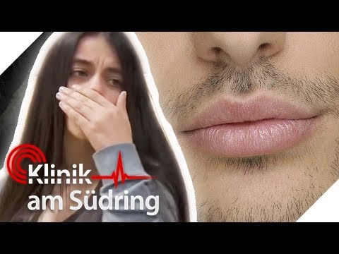 Bart als Mädchen! Amelie (16) hat peinlichen Damenbart-Fail! | Klinik am Südring | SAT.1