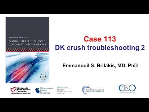 Case 113: PCI Manual - DK crush troubleshooting 2