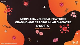 Neoplasia Part 5 | Clinical features, grading & staging and lab diagnosis | General Pathology 2025