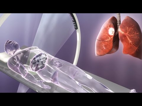 Wie, ob oder ob nicht eine gesunde Prostata bestimmen Cho ein Prostatitis