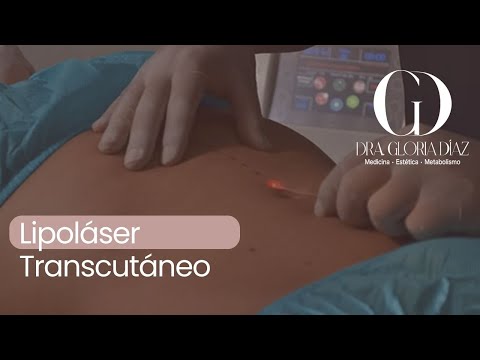 LIPOLASER TRANSCUTANEO Saludarte Tv