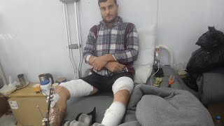 لحظة لا تُنسى أب مصاب يرى أبناءه المواليد لأول مرة بعد 15 يومًا رغم الإصابة والحرب الحمدلله 🤲🤲