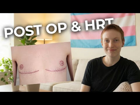 6 Weeks Post Op  FTM Top Surgery + 2 Weeks On Testosterone HRT