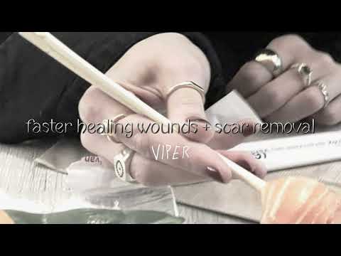 fasterhealingwounds.