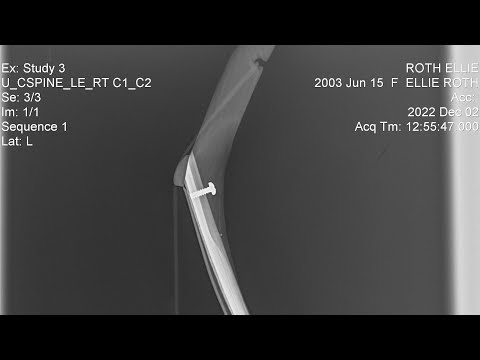 Grozer Turkish Bow X-Ray Pics/Discussion