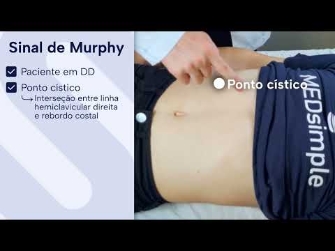Murphy's Sign: Physical Examination of the Abdomen