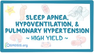 Apnea, hypoventilation, and pulmonary hypertension: Pathology review
