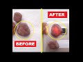 Raw Ruby Stone | Before and After | Rough Gemstones #shorts