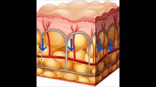 ULTRACAVITACIÓN Y CELULITIS