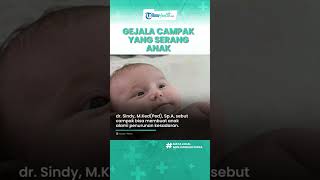 Mengenal Gejala Penyakit Campak yang Kerap Dialami Anak, Munculnya Ruam hingga Badan Lemas
