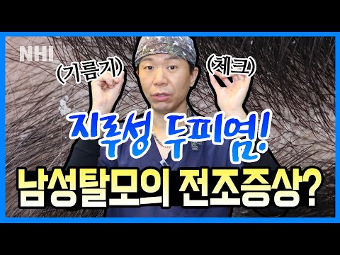 지루성 두피염이 남성탈모의 전조 증상?ㅣ뉴헤어