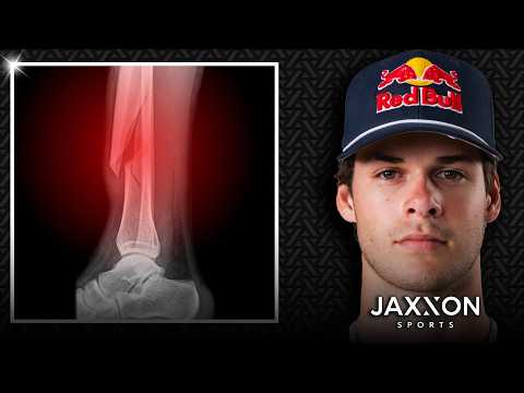 Jett Lawrence Reveals the Extent of His Injurys