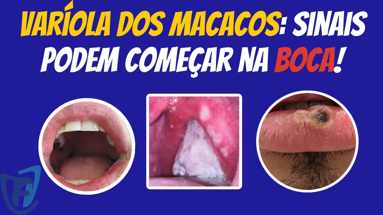 Francisco De Assis Almeida Lima Júnior-57