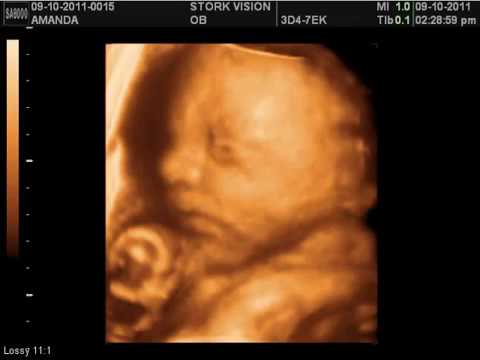 Click to Watch the North Dakota is the First Free State for Unborn Children and Governor Jack Dalrymple is a Hero video