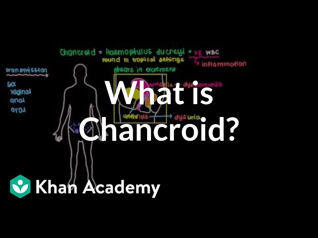 Video Pronunciation of chancre in English