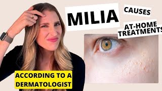 Milia: Causes, At-Home Skincare Treatments, & Prevention | Dr. Sam Ellis