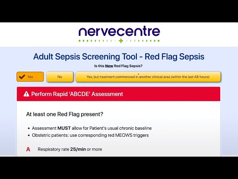 How to complete a Sepsis eAssessment on Nervecentre