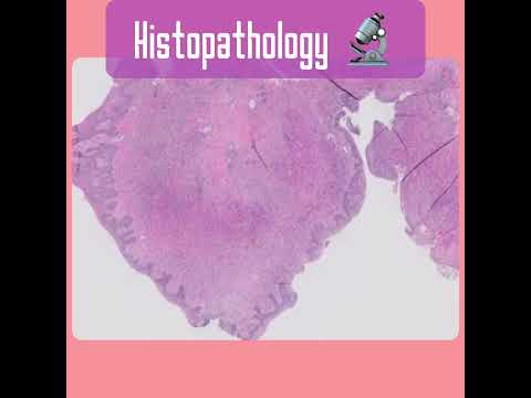 Cat Eosinophilic Granuloma Complex