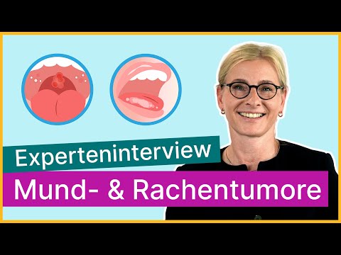 Pregabalin für Rückenschmerzen Magenschmerzen in den unteren Rücken und Händen kann es sein,