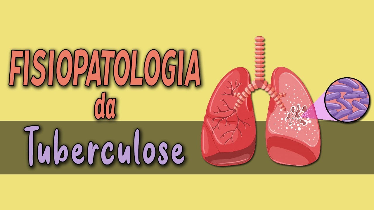🔴 [LIVE] Fisiopatologia da Tuberculose │ PORTH - Capítulo 36
