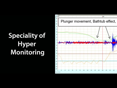 Condition monitoring specialties for Hyper compressors