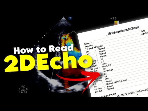 2DEcho || How to READ 2DEcho report || Echocardiography • Daily Cardiology