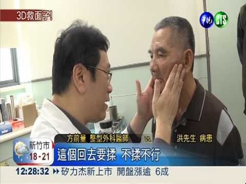 摔傷骨折臉變形 3D重建救破相