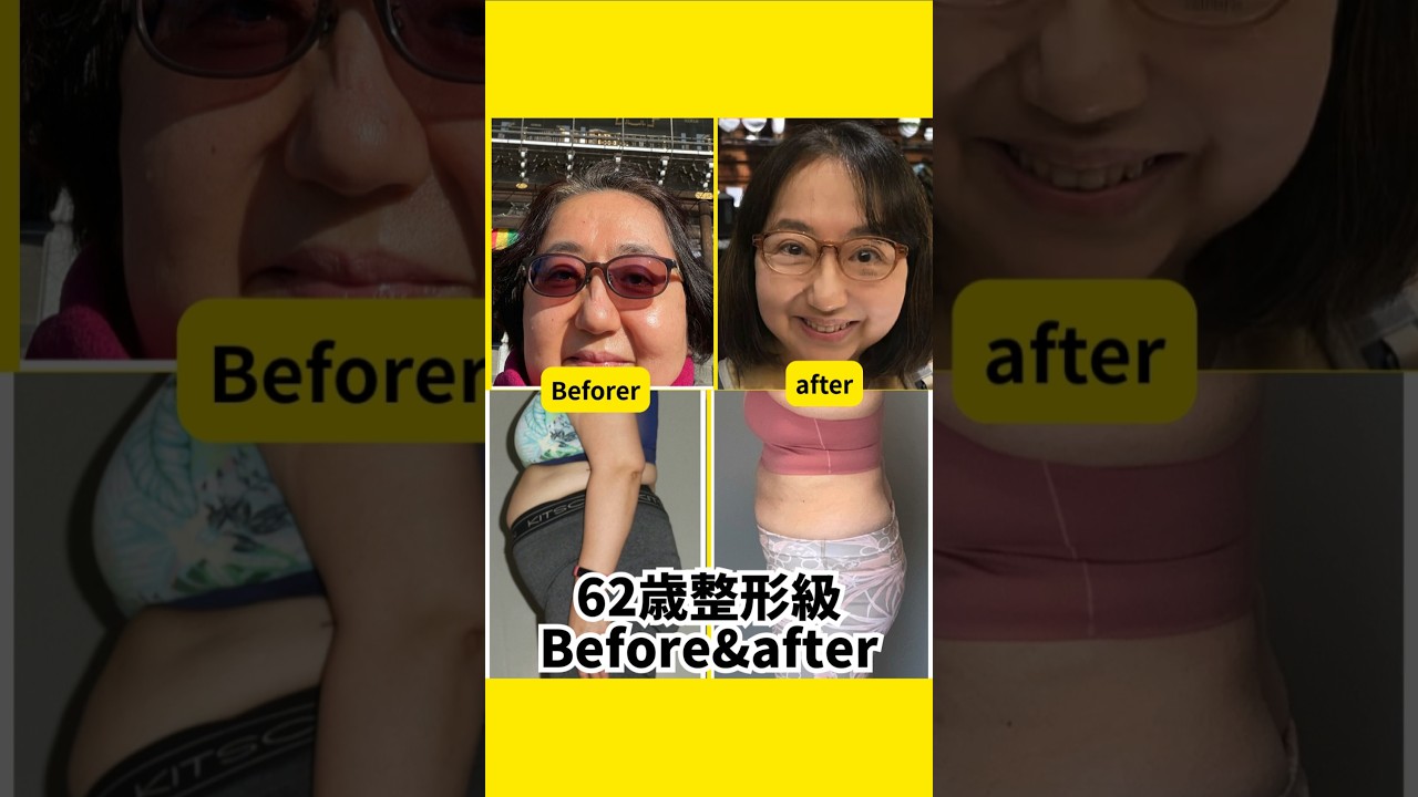 【62歳】衝撃のビフォーアフター❗同一人物？！整形疑惑？