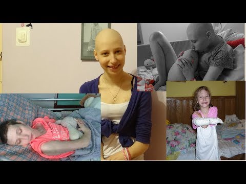 Gimnastyka w koślawego stóp u dzieci Zdjęcia deformacja stóp
