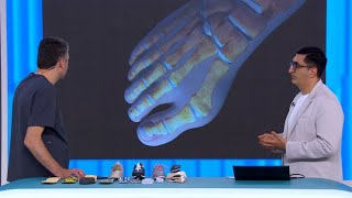 Եղիր առողջ. ոտնաթաթի դեֆորմացիա