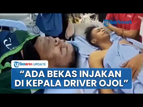 Kondisi Memprihatinkan Driver Ojol Diduga Dikeroyok Polisi: Bekas Injakan di Kepala, Rusuk Ditendang
