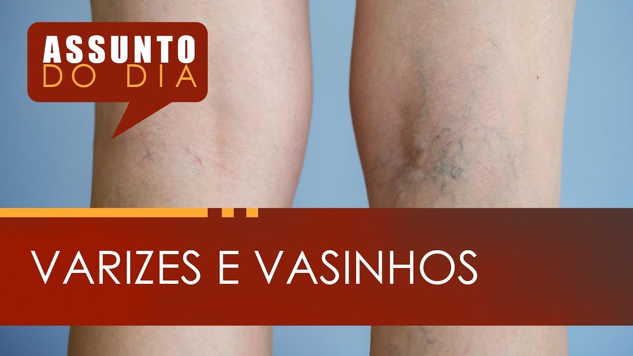 Carlos Eduardo Cunha-14