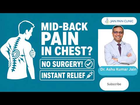 Watch video on Thoracic Facet RFA