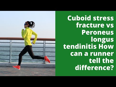 Cuboid stress fracture vs  Peroneus longus tendinitis  How can a runner tell the difference?