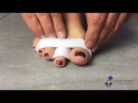 Zelfzorg - Tenen over elkaar - Fixteen