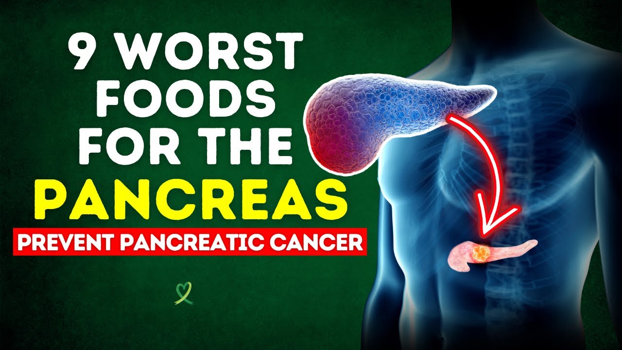 9 Worst Foods for the Pancreas (Prevent Pancreatic Cancer)