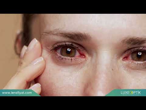 Gözde Işık Çakması Nedir? - Lens Tv
