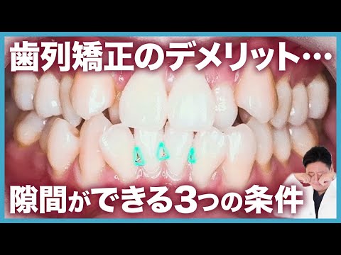 デンタルリウムについて詳しく解説