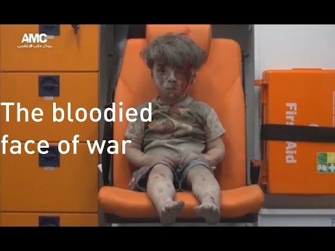 シリアの瓦礫の中から5歳のオムラン・ダクニーシュが引き揚げられた (Five-year-old Omran Daqneesh pulled from rubble in Syria)
