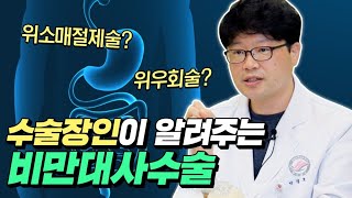 [TV] 񸸴 ұ? 񸸴 輺 Ȯϰ ˷帳ϴ