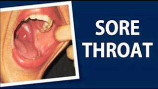Download lagu Extremely Powerful Sore Throat Treatment, Binaural Beats Healing Frequencies for Sore Throat Sounds mp3 Download lagu Extremely Powerful Sore Throat Treatment, Binaural Beats Healing Frequencies for Sore Throat Sounds mp3