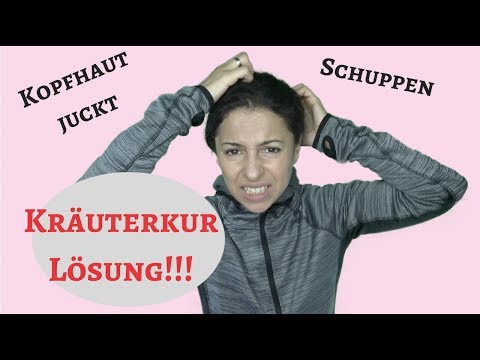 Das Ekzem die Spezies die Behandlung Ob man die Kinder in bei der Schuppenflechte gebären kann