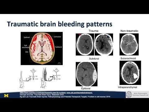 1. Emergency neurosurgery  - Overview of neurosurgical emergencies