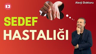 Sedef Hastalığı - Alerji Doktoru Prof. Dr. Ahmet Akçay