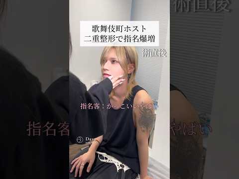 [Double eyelid surgery] Host gets a huge increase in requests after surgery? #shorts